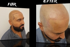 Psykologiske aspekter: